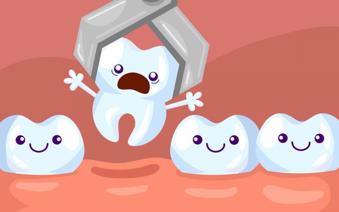 Why to NEVER Pull Teeth At Home