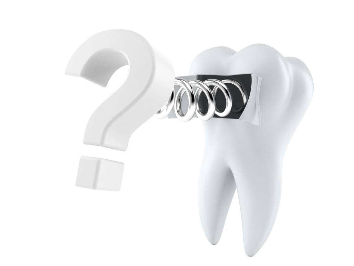 Featured image for What to Know Before Your First Tooth Extraction